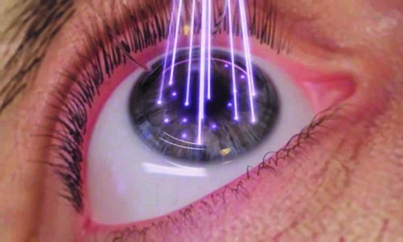 کاربردهای لیزر در درمان بیماری های قرنیه چشم