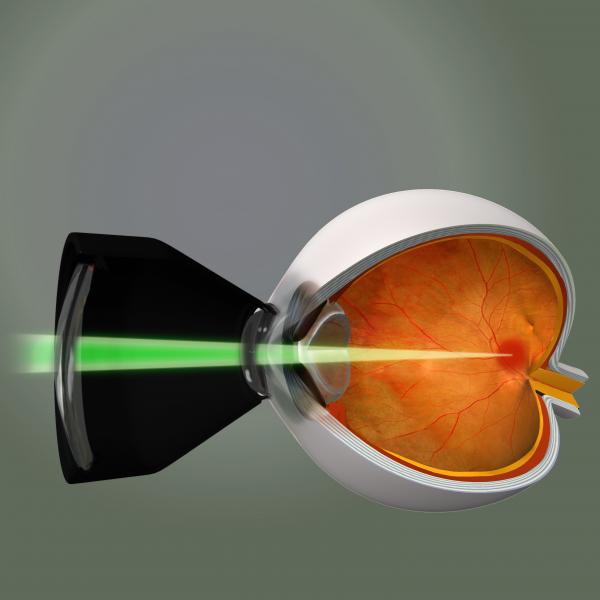 کاربردهای لیزر در درمان بیماری های شبکیه چشم