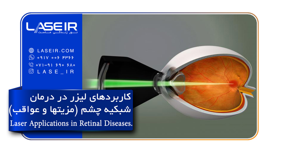 لیزر چه کاربردهایی در درمان بیماری های شبکیه چشم دارد؟